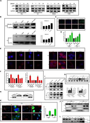 Blockage of Extracellular Signal-Regulated Kinase Exerts an Antitumor Effect via Regulating Energy Metabolism and Enhances the Efficacy of Autophagy Inhibitors by Regulating Transcription Factor EB Nuclear Translocation in Osteosarcoma